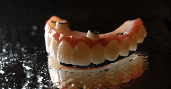 implant dentist Grayson