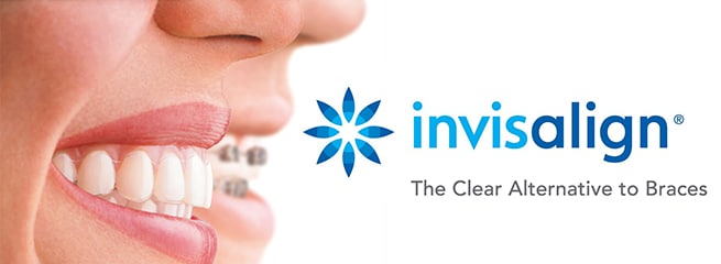 invisalign clear braces aligners grayson ga