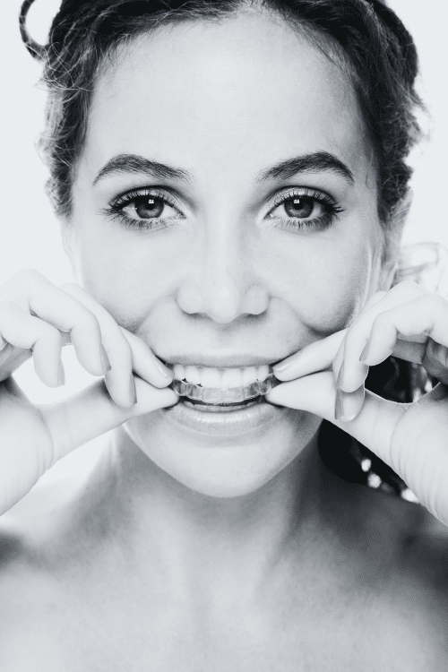 invisalign clear braces & aligners